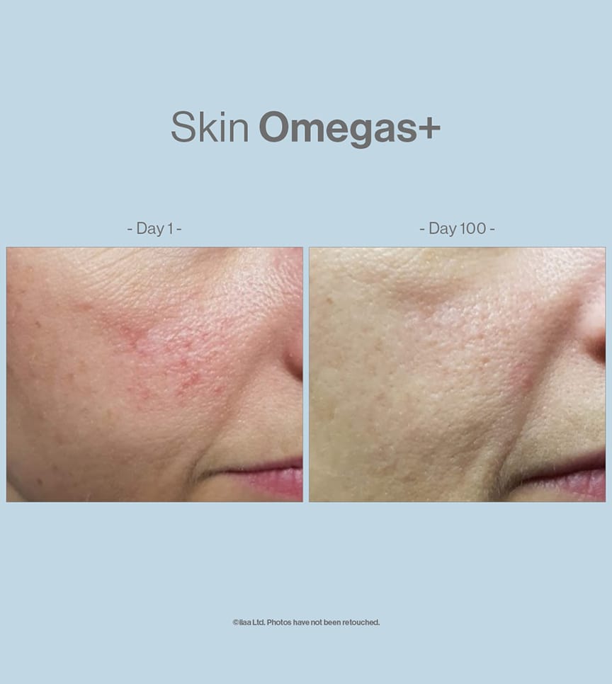 Advanced Nutrition Programme Skin Omegas